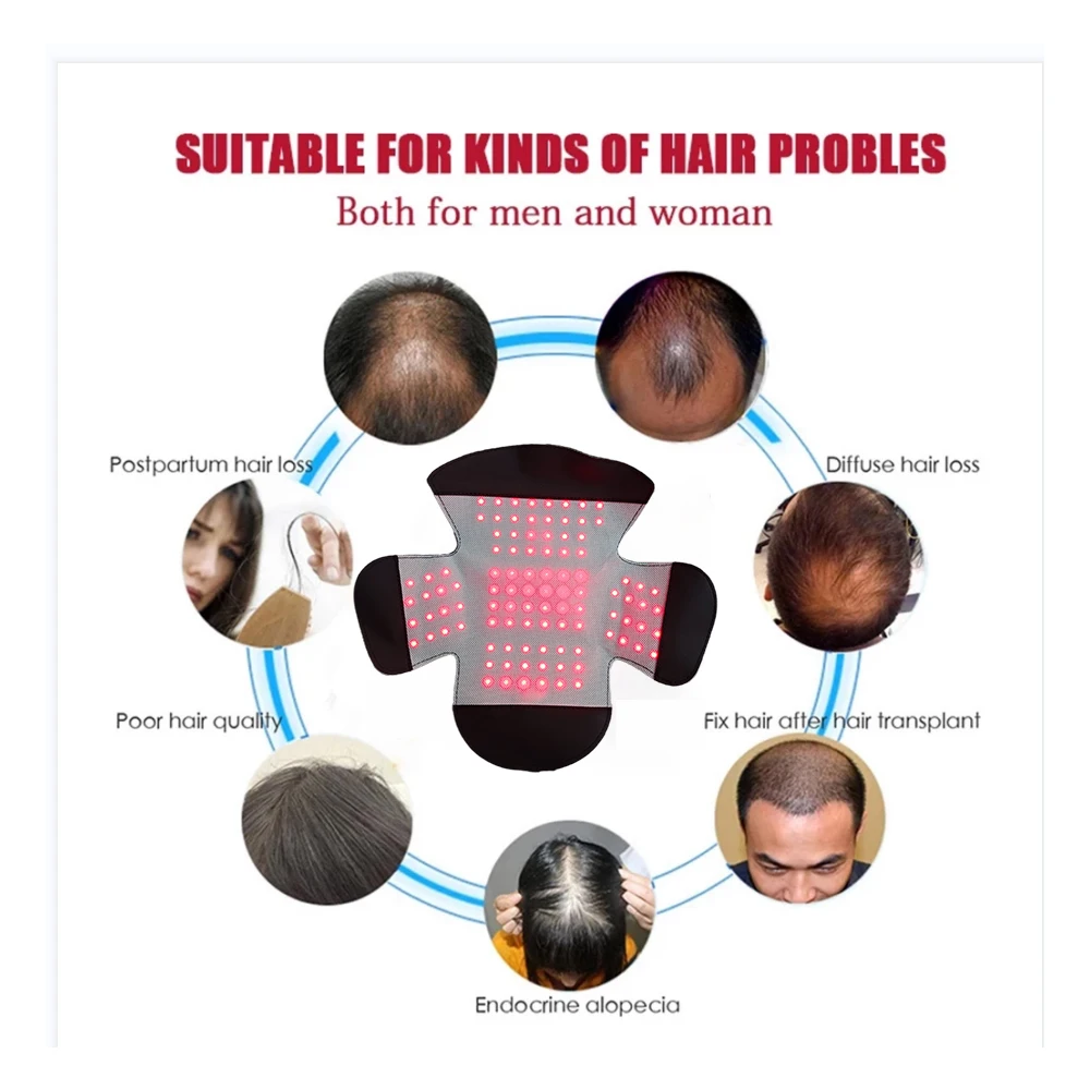 Каска за лечение на растежа на коса с терапия с червена светлина, устройство за лечение на косопад и кожата на главата, благоприятства за възстановяване на растежа на косата, масажор за косата на главата1