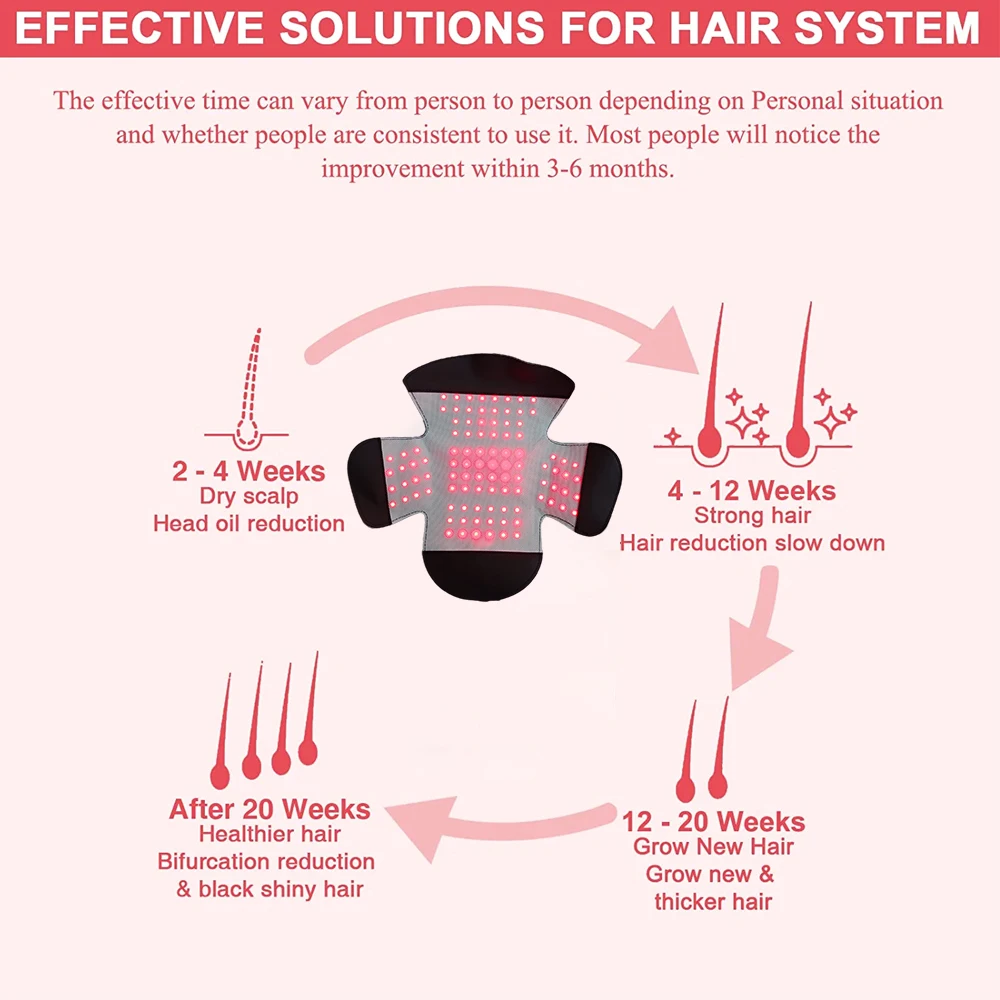 Каска за лечение на растежа на коса с терапия с червена светлина, устройство за лечение на косопад и кожата на главата, благоприятства за възстановяване на растежа на косата, масажор за косата на главата3