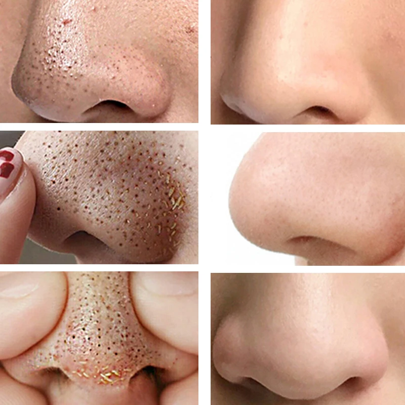 Маска за носа Контрол масла за Премахване на пъпки Отшелушивающее Дълбоко почистване Стесняване на порите на Възстановяване на увредените тъкани на кожата Грижа за лицето-30 г1