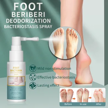 Бактерии за краката бактериостаз дезодорант-спрей, за Бързо усвояването Премахва гъбички на краката